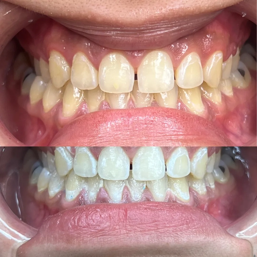 Placeholder image for PRODUCT