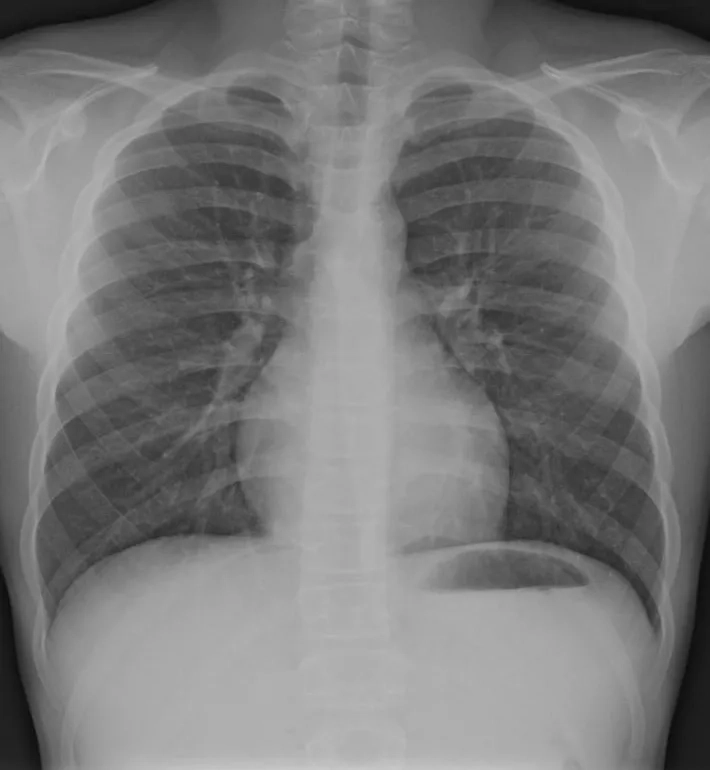 Placeholder image for PRODUCT