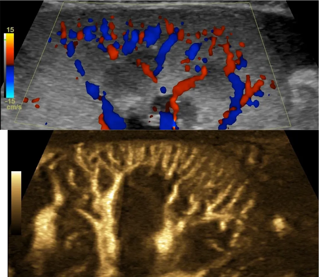 Placeholder image for PRODUCT